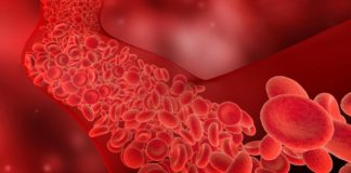 Meszesedés visszafordítása: modern megoldások a hatékony egészségvédelemben meszesedes