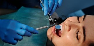 Fogpótlások rögzítése cinkfoszfát ragasztócementtel fogászat